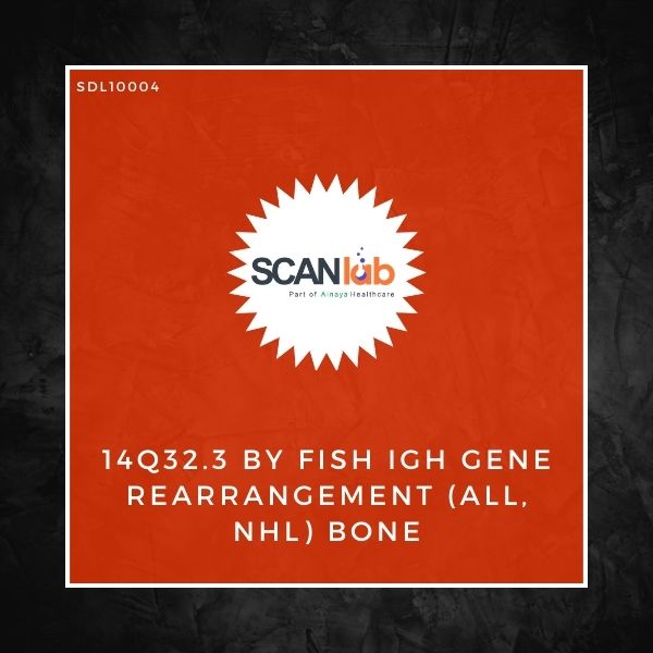 14Q32.3 BY FISH IGH GENE REARRANGEMENT (ALL, NHL) BONE (SDL10004)