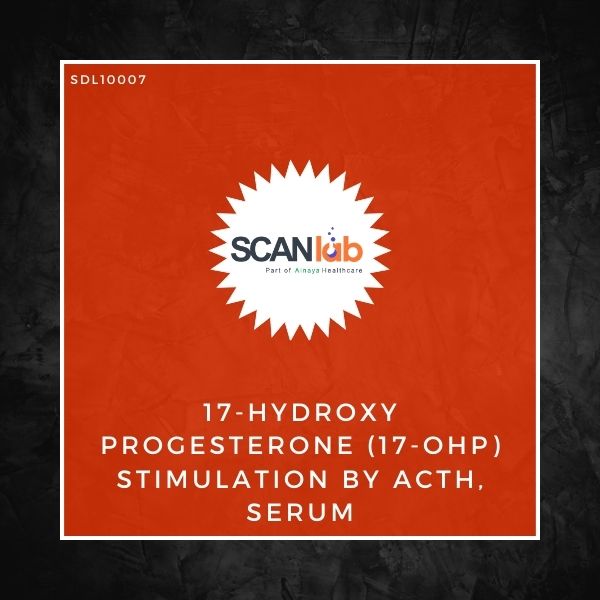 17-HYDROXY PROGESTERONE (17-OHP) STIMULATION BY ACTH, SERUM (SDL10007)