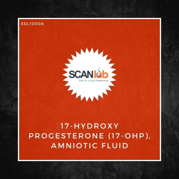 17-HYDROXY PROGESTERONE (17-OHP), AMNIOTIC FLUID (SDL10008)