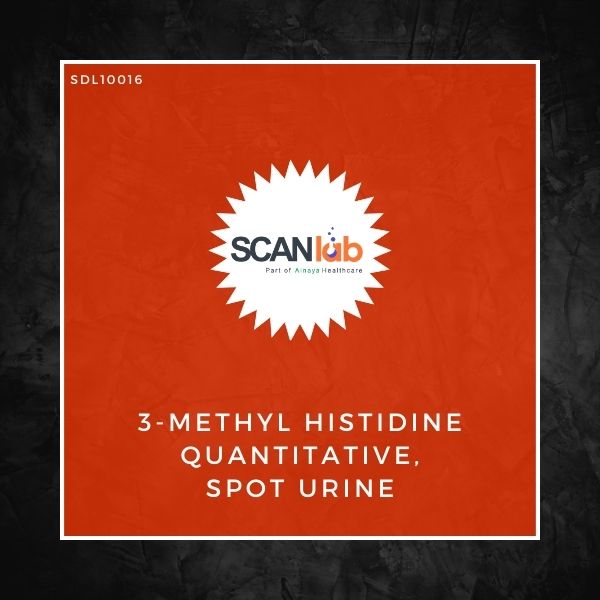 3-METHYL HISTIDINE QUANTITATIVE, SPOT URINE (SDL10016)