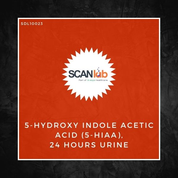 5-HYDROXY INDOLE ACETIC ACID (5-HIAA), 24 HOURS URINE (SDL10023)