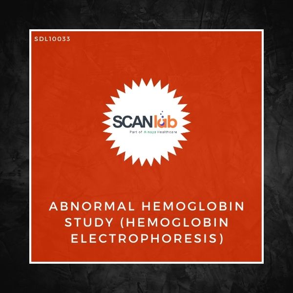 ABNORMAL HEMOGLOBIN STUDY (HEMOGLOBIN ELECTROPHORESIS) (SDL10033)