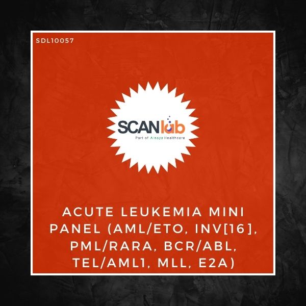 ACUTE LEUKEMIA MINI PANEL (AML/ETO, INV[16], PML/RARA, BCR/ABL, TEL/AML1, MLL, E2A) (SDL10057)