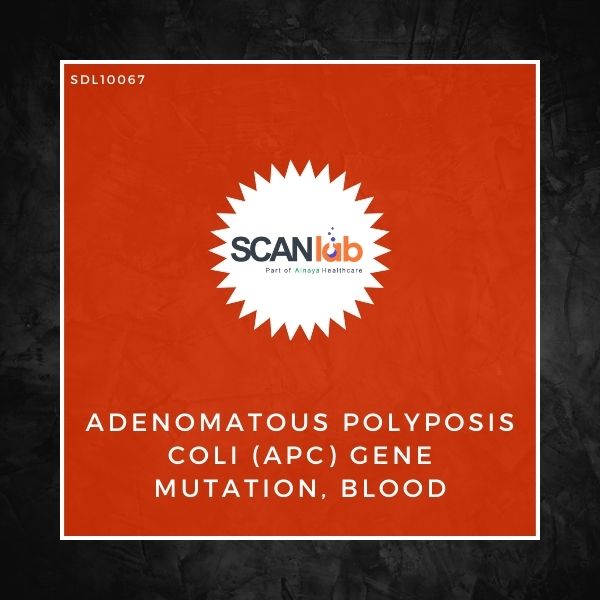 ADENOMATOUS POLYPOSIS COLI (APC) GENE MUTATION, BLOOD (SDL10067)