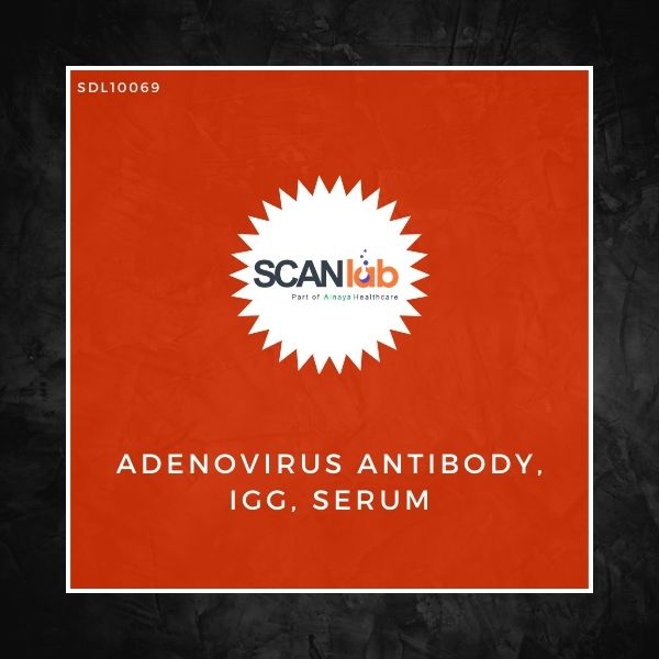 ADENOVIRUS ANTIBODY, IGG, SERUM (SDL10069)