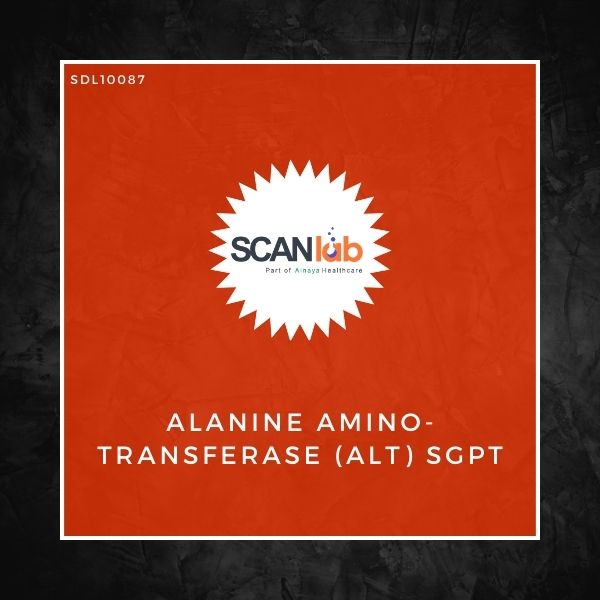 ALANINE AMINO-TRANSFERASE (ALT) SGPT (SDL10087)