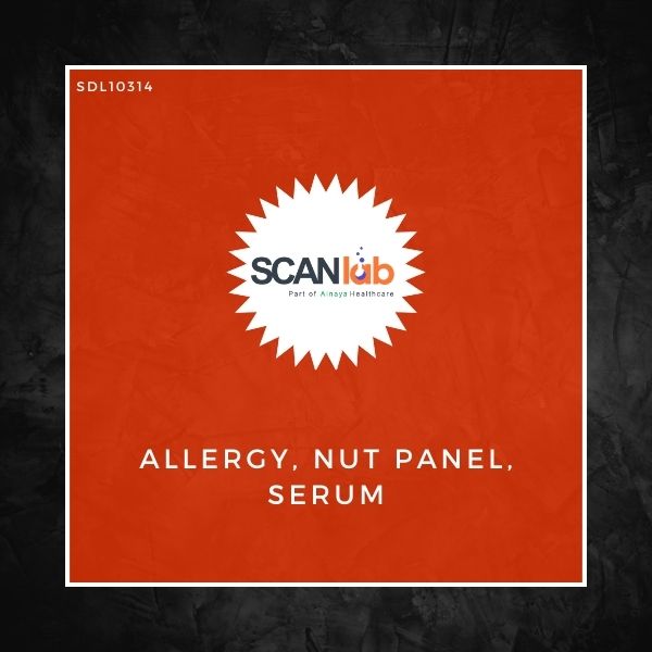 ALLERGY, NUT PANEL, SERUM (FEIA) (SDL10314)