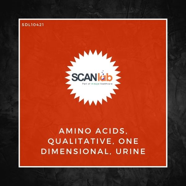 AMINO ACIDS, QUALITATIVE, ONE DIMENSIONAL, URINE (SDL10421)
