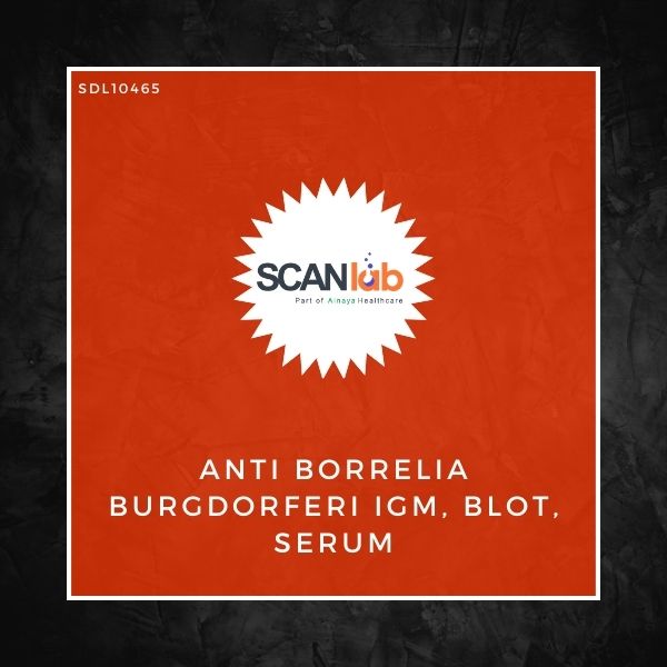 ANTI BORRELIA BURGDORFERI IGM, BLOT, SERUM (SDL10465)