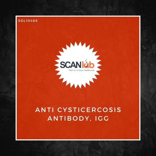 ANTI CYSTICERCOSIS ANTIBODY, IGG (SDL10468)