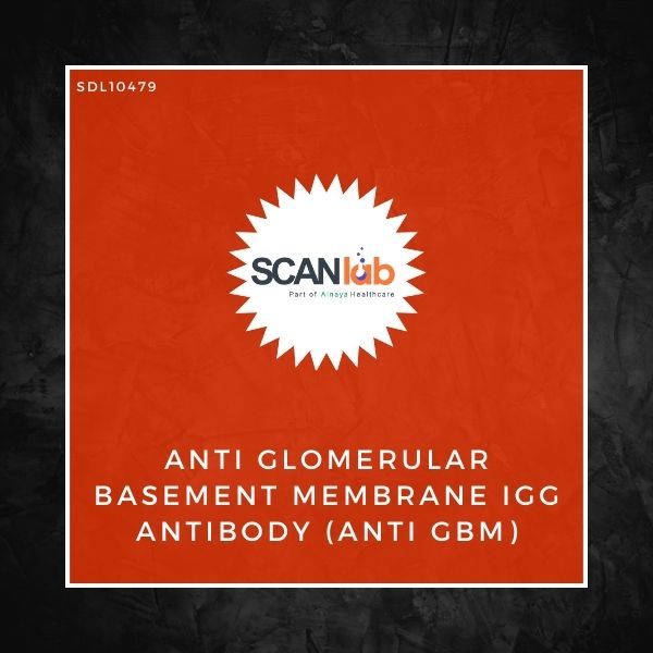 ANTI GLOMERULAR BASEMENT MEMBRANE IGG ANTIBODY (ANTI GBM) (SDL10479)