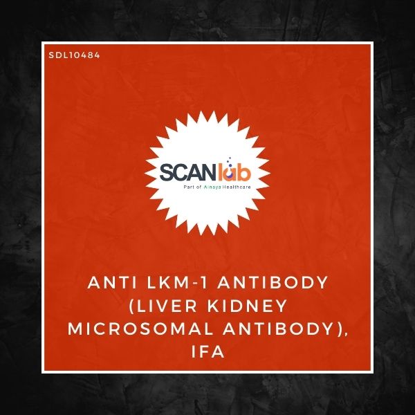 ANTI LKM-1 ANTIBODY (LIVER KIDNEY MICROSOMAL ANTIBODY), IFA (SDL10484)