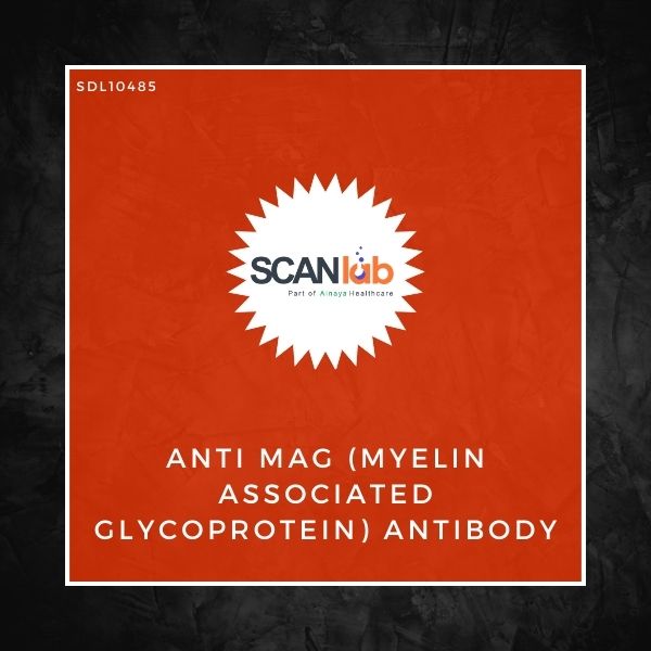 ANTI MAG (MYELIN ASSOCIATED GLYCOPROTEIN) ANTIBODY (SDL10485)