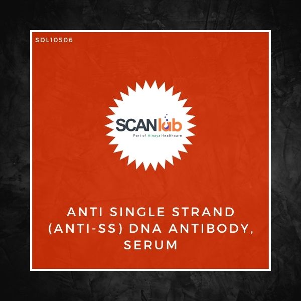 ANTI SINGLE STRAND (ANTI-SS) DNA ANTIBODY, SERUM (SDL10506)