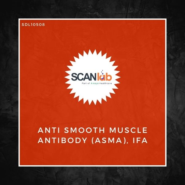 ANTI SMOOTH MUSCLE ANTIBODY (ASMA), IFA (SDL10508)
