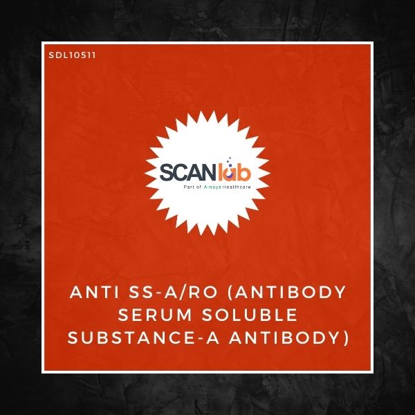 ANTI SS-A/RO (ANTIBODY SERUM SOLUBLE SUBSTANCE-A ANTIBODY) (SDL10511)