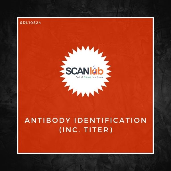 ANTIBODY IDENTIFICATION (INC. TITER) (SDL10524)