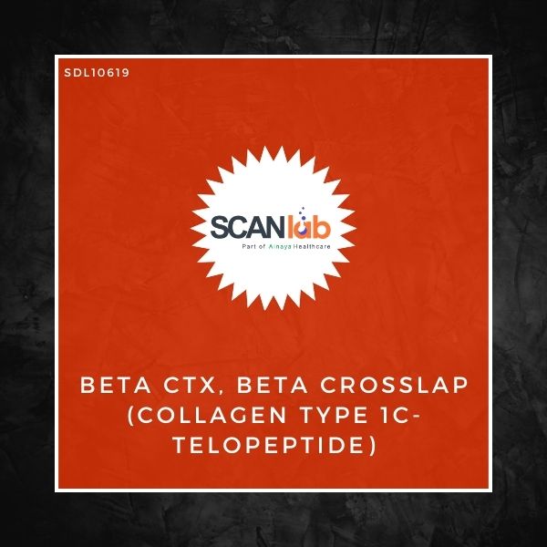 BETA CTX, BETA CROSSLAP (COLLAGEN TYPE 1C- TELOPEPTIDE) (SDL10619)