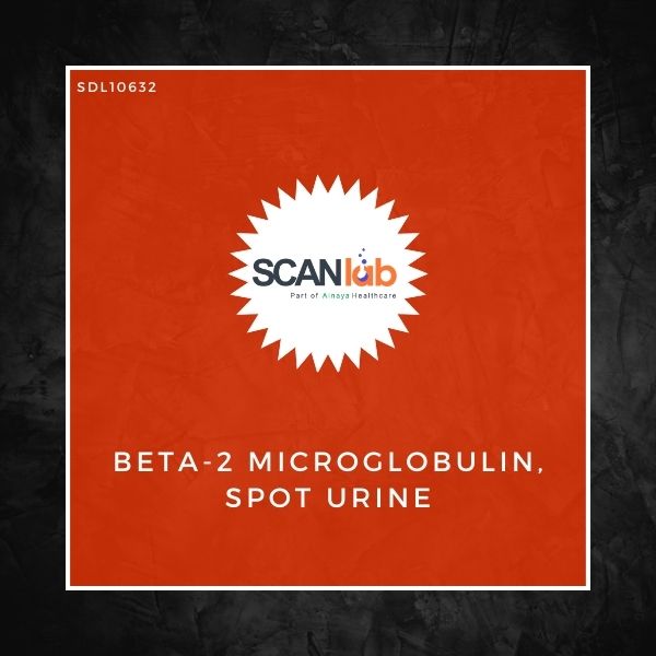 BETA-2 MICROGLOBULIN, SPOT URINE (SDL10632)