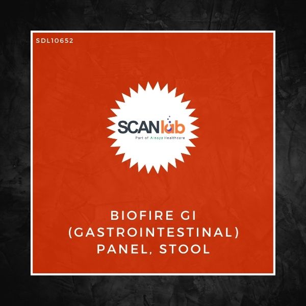 BIOFIRE GI (GASTROINTESTINAL) PANEL, STOOL (SDL10652)