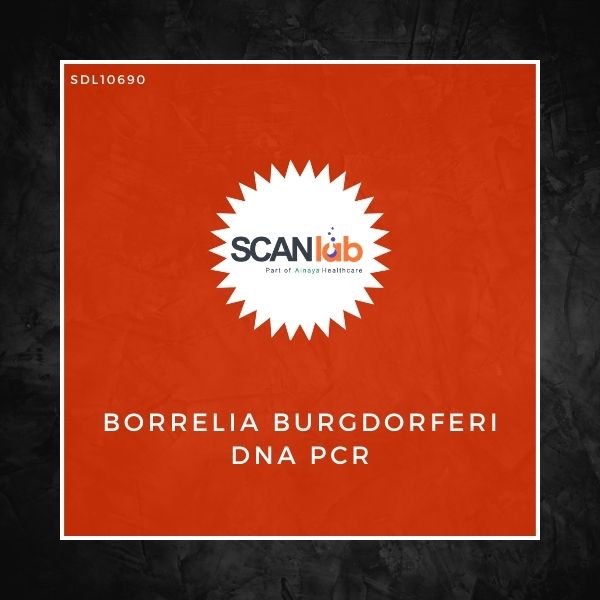 BORRELIA BURGDORFERI DNA PCR (SDL10690)