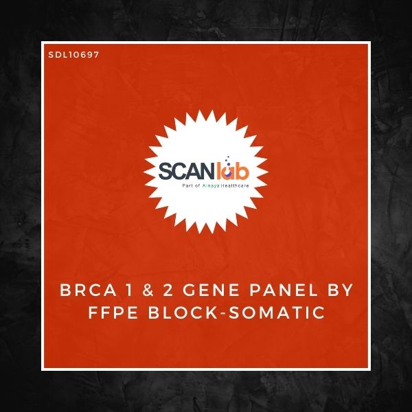BRCA 1 & 2 GENE PANEL BY FFPE BLOCK-SOMATIC (SDL10697)