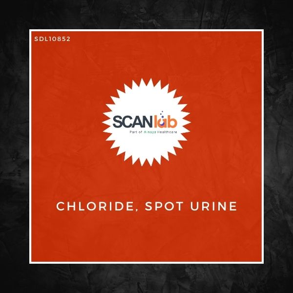 CHLORIDE, SPOT URINE (SDL10852)