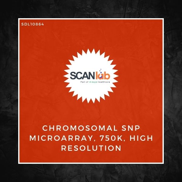 CHROMOSOMAL SNP MICROARRAY, 750K, HIGH RESOLUTION (SDL10864)