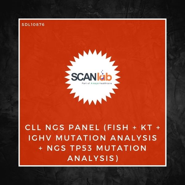 CLL NGS PANEL (FISH+KT+IGHV MUTATION ANALYSIS+NGS TP53 MUTATION ANALYSIS) (SDL10876)