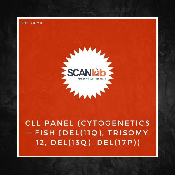 CLL PANEL (CYTOGENETICS+FISH [DEL(11Q), TRISOMY 12, DEL(13Q), DEL(17P)) (SDL10878)