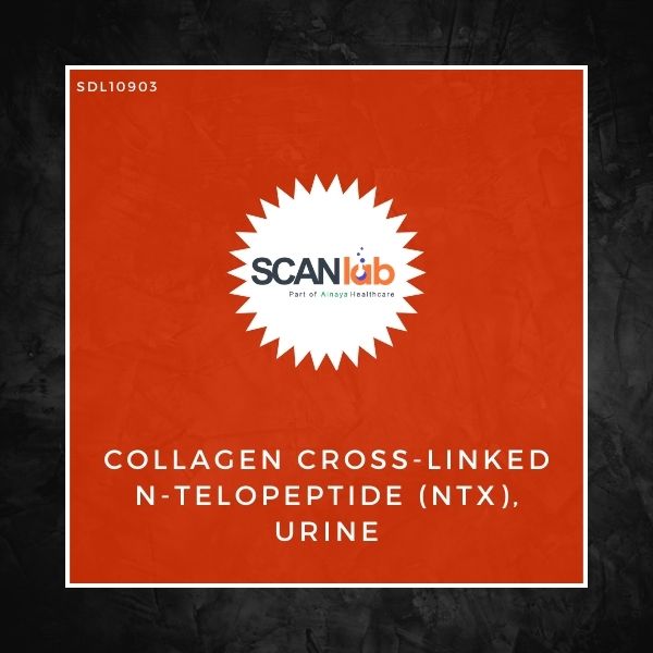 COLLAGEN CROSS-LINKED N-TELOPEPTIDE (NTX), URINE (SDL10903)