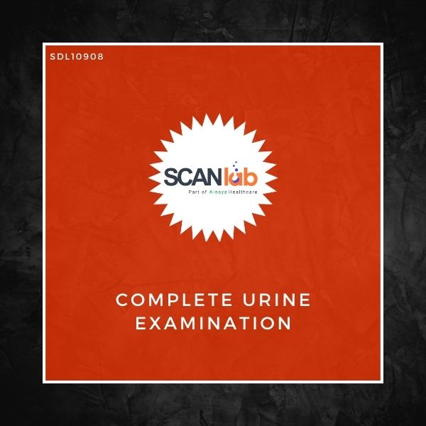 COMPLETE URINE EXAMINATION (SDL10908)