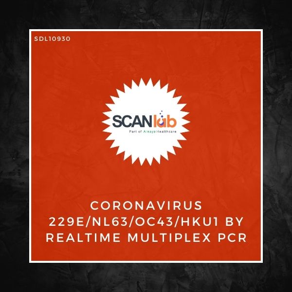 CORONAVIRUS 229E/NL63/OC43/HKU1 BY REALTIME MULTIPLEX PCR (SDL10930)