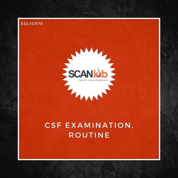 CSF EXAMINATION, ROUTINE (SDL10978)