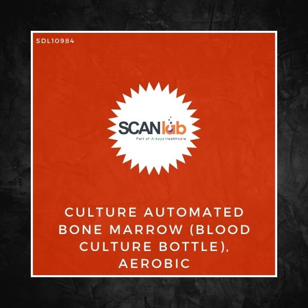 CULTURE AUTOMATED BONE MARROW (BLOOD CULTURE BOTTLE), AEROBIC-VITEK (SDL10984)