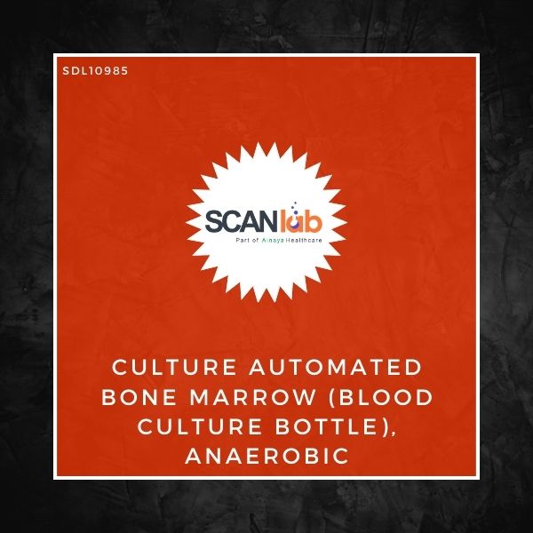 CULTURE AUTOMATED BONE MARROW (BLOOD CULTURE BOTTLE), ANAEROBIC- VITEK (SDL10985)