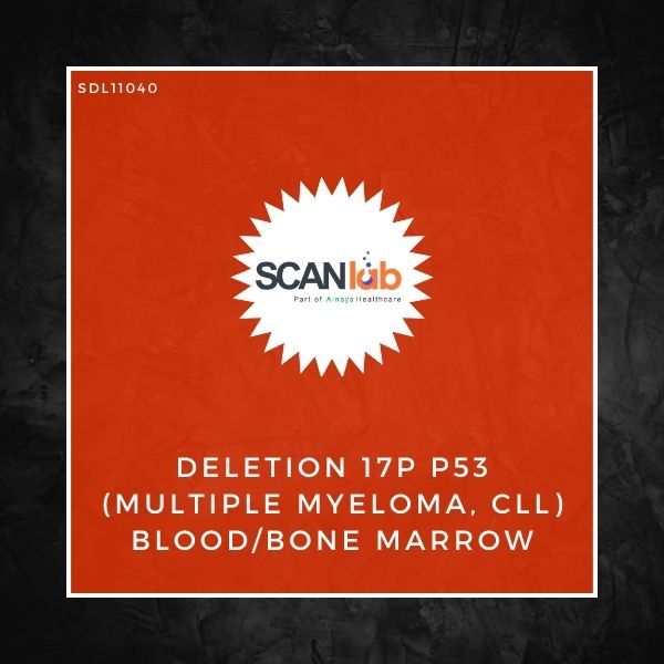 DELETION 17P P53 (MULTIPLE MYELOMA, CLL) BLOOD/BONE MARROW (SDL11040)