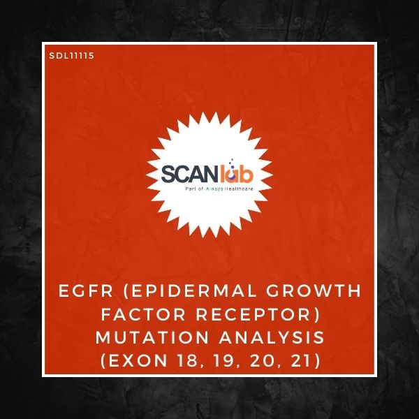 EGFR (EPIDERMAL GROWTH FACTOR RECEPTOR) MUTATION ANALYSIS (EXON 18, 19, 20, 21) (SDL11115)