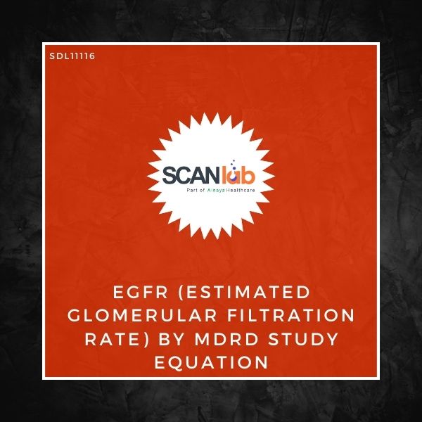 EGFR (ESTIMATED GLOMERULAR FILTRATION RATE) BY MDRD STUDY EQUATION (SDL11116)