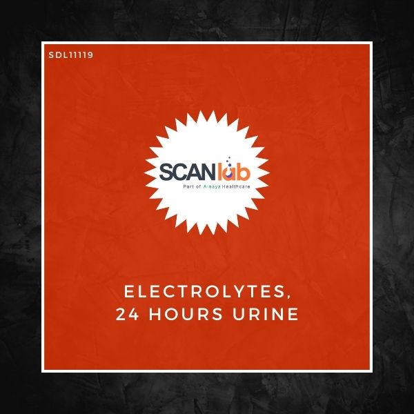 ELECTROLYTES, 24 HOURS URINE (SDL11119)