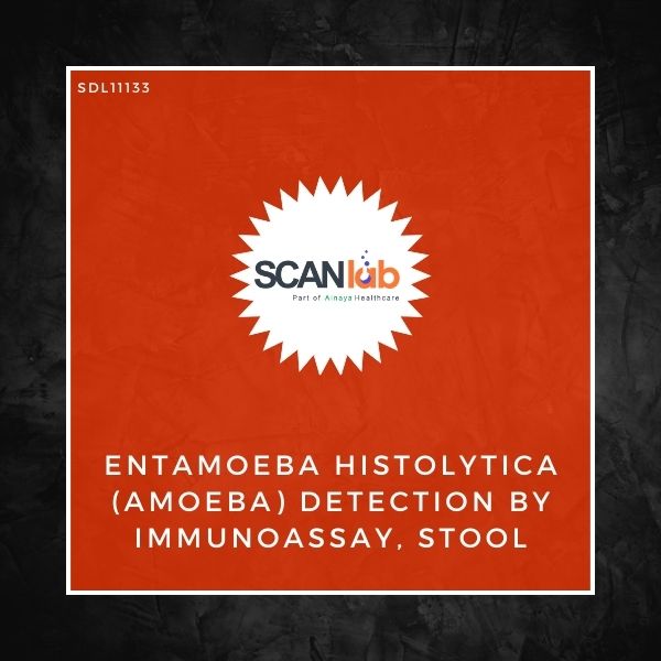 ENTAMOEBA HISTOLYTICA (AMOEBA) DETECTION BY IMMUNOASSAY, STOOL (SDL11133)