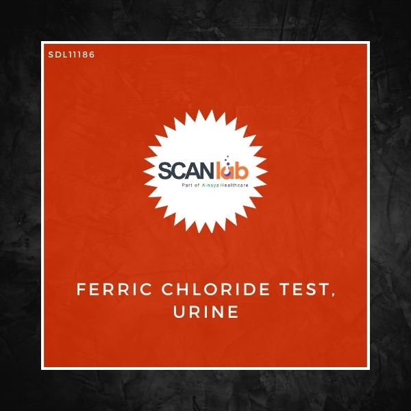 FERRIC CHLORIDE TEST, URINE (SDL11186)