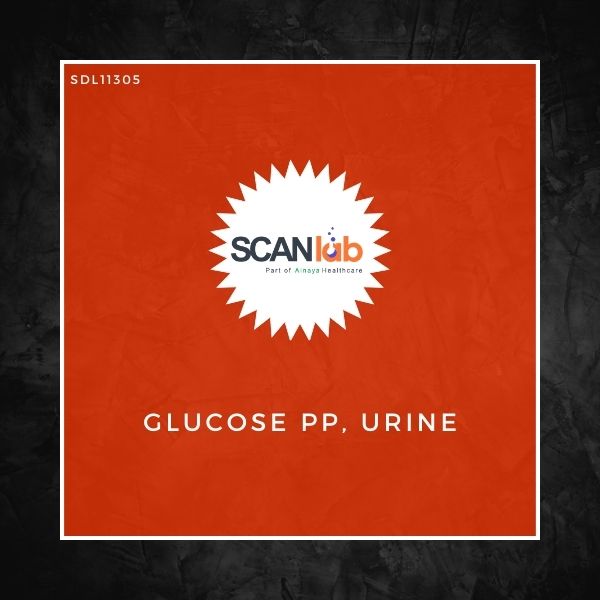 GLUCOSE PP, URINE (SDL11305)