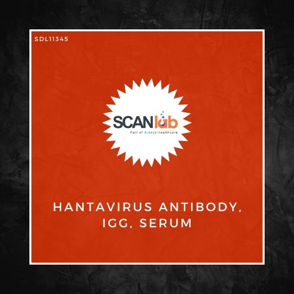 HANTAVIRUS ANTIBODY, IGG, SERUM (SDL11345)