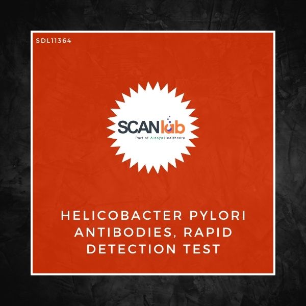 HELICOBACTER PYLORI ANTIBODIES, RAPID DETECTION TEST (SDL11364)