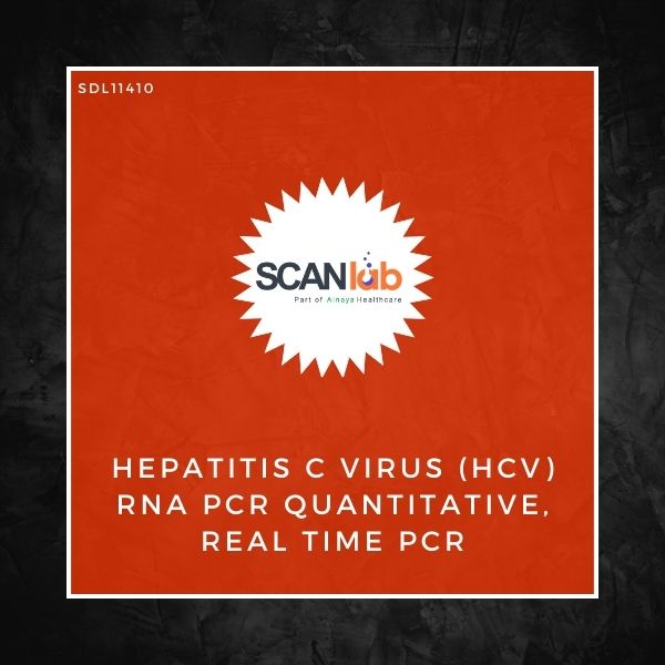 HEPATITIS C VIRUS (HCV) RNA PCR QUANTITATIVE, REAL TIME PCR (SDL11410)