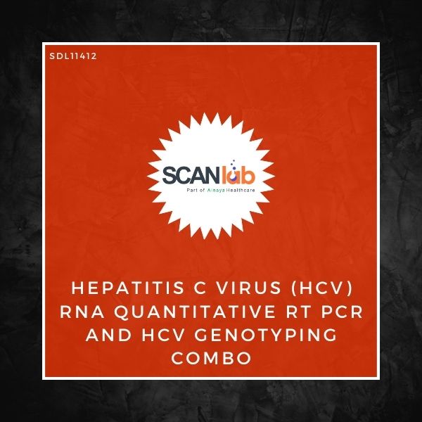 HEPATITIS C VIRUS (HCV) RNA QUANTITATIVE RT PCR AND HCV GENOTYPING COMBO (SDL11412)