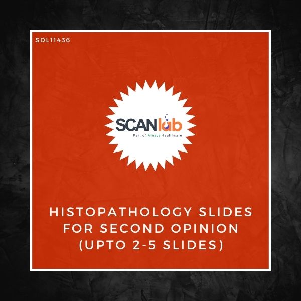 HISTOPATHOLOGY SLIDES FOR SECOND OPINION (UPTO 2-5 SLIDES) (SDL11436)