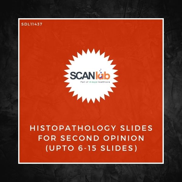 HISTOPATHOLOGY SLIDES FOR SECOND OPINION (UPTO 6-15 SLIDES) (SDL11437)