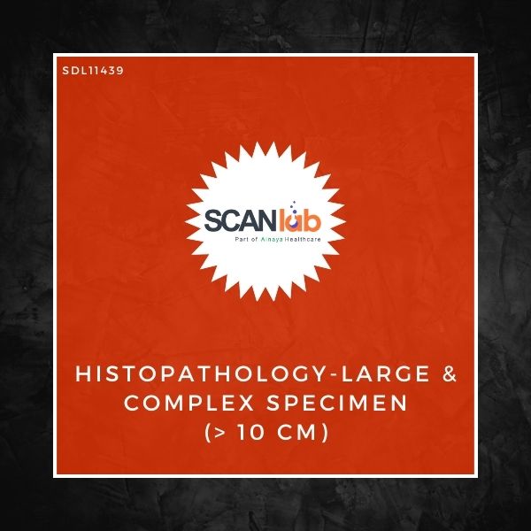 HISTOPATHOLOGY-LARGE & COMPLEX SPECIMEN (> 10 CM) (SDL11439)